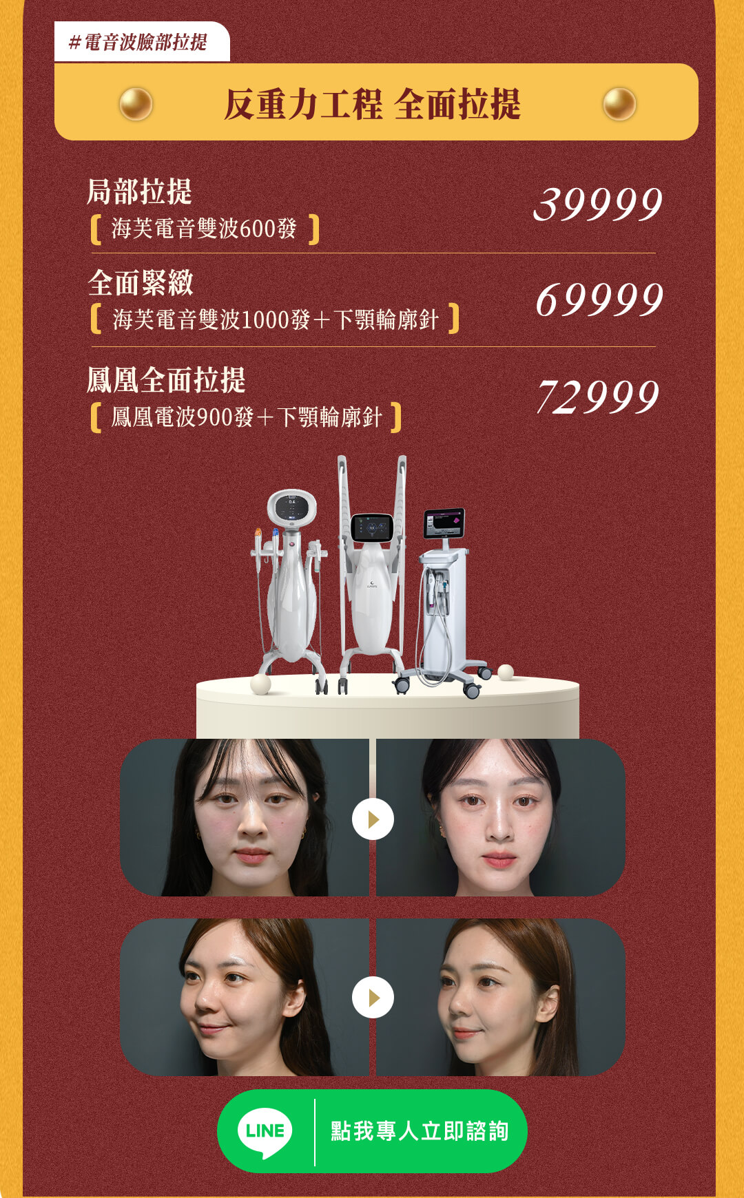 【2026母親節】 媽咪的復刻計畫｜電音波拉提